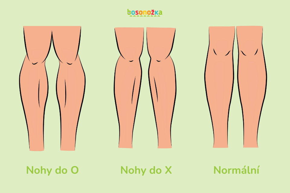 nohy do O a nohy do X srovnání